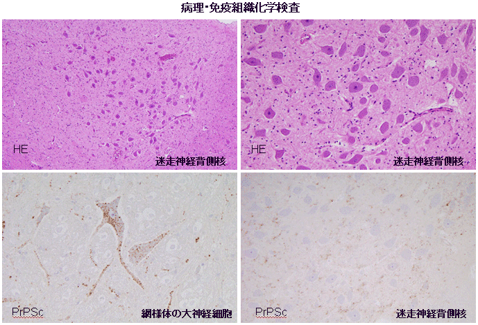病理・免疫組織化学検査